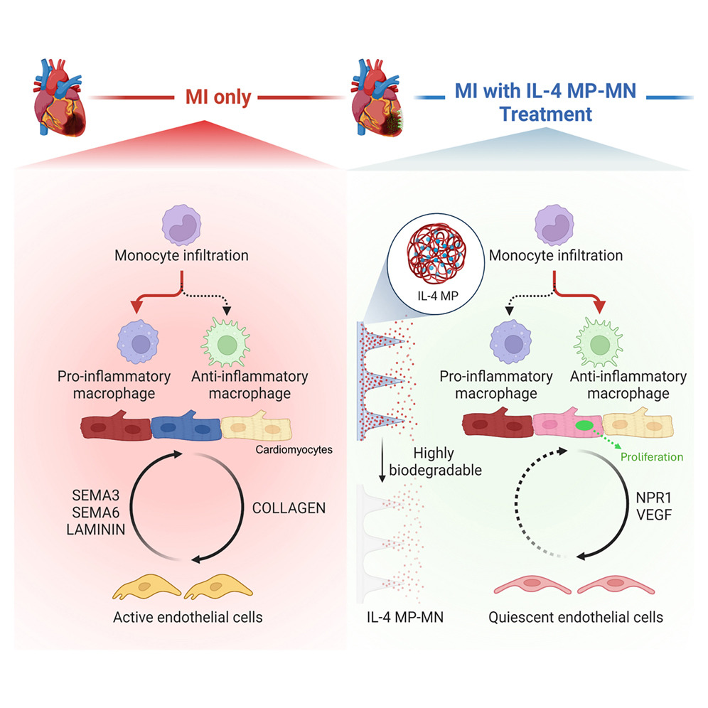 Επίθεμα με μικροβελόνες επιδιορθώνει κατεστραμμένο καρδιακό μυ μετά από έμφραγμα
