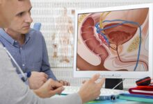 Οι-8-χειρότερες-τροφές-για-την-υγεία-του-προστάτη