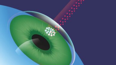 Πώς-αντιμετωπίζεται-το-γλαύκωμα-χωρίς-φάρμακα;