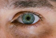 Υπερμετρωπία:-Πώς-μπορεί-να-διορθωθεί-με-ελάχιστα-επεμβατικό-τρόπο;